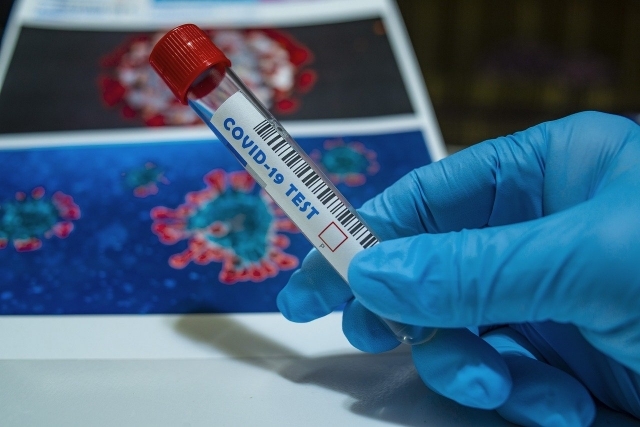 У Славутичі 25 нових випадків захворювання на коронавірус  фото